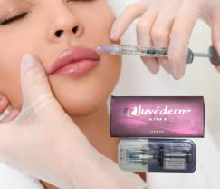 2 X 1 ml Juvederm Ultra 4 Injeksi Filler Kulit Injeksi Lip Filler