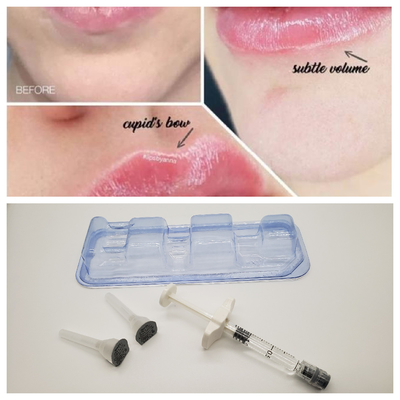 1 ml Juvederm Medical Sodium Hyaluronate Gel Hyaluronic Acid Gel Injeksi Untuk Jembatan Hidung