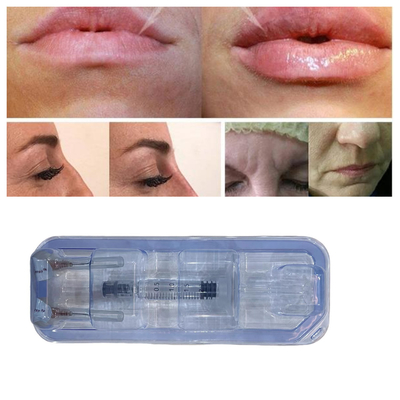 Injeksi Ha Hyaluronic Acid Lip Filler Injeksi 24mg/Ml Perawatan Wajah