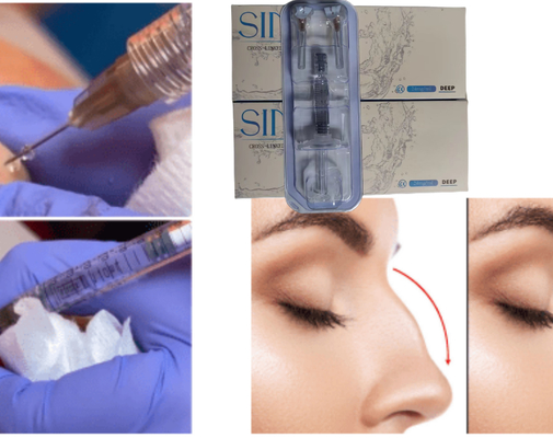 Asam Hyaluronic Injeksi Wajah Lip Dermal Filler Ce MSDS ISO