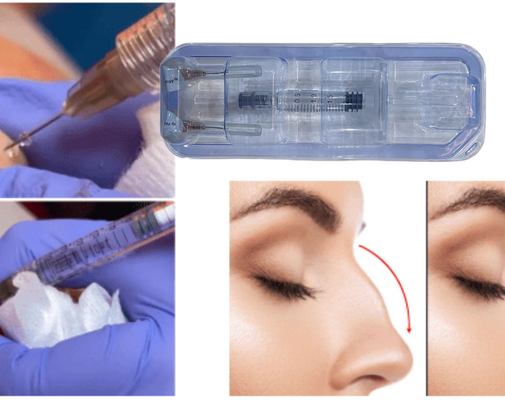 FDA menyetujui suntikan Hyaluronic Acid Gel untuk punggung.