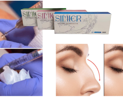 Transparan 10ml Sodium Hyaluronate Gel Injeksi Perawatan Untuk Mengisi Garis-garis Senyum