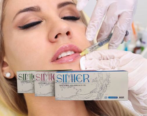 Filler Asam Hyaluronic Gel 5ml Lip Filler Injeksi Filler Dermal Injeksi