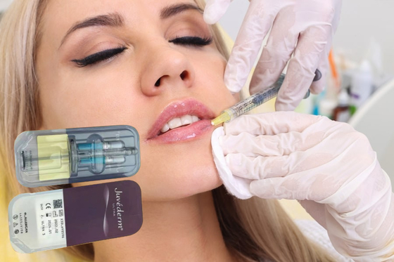 Deep 2ml 1ml Hyaluronic Acid Lip Fillers Wanita Injeksi OEM ODM