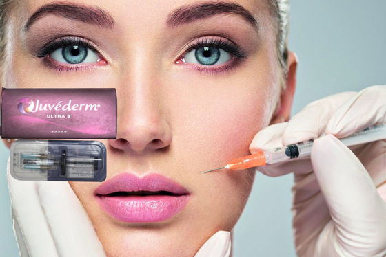 1 ml Juvederm Medical Sodium Hyaluronate Gel Hyaluronic Acid Gel Injeksi Untuk Jembatan Hidung