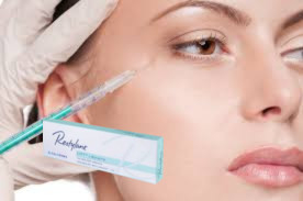 27G Marionette Lines Hyaluronic Acid Filler 1ml Deep Line Fillers dengan Lido