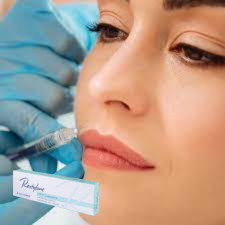 Asam Hyaluronic Injeksi Filler Kulit Gel Injeksi Untuk Bibir