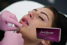 Female Crosslinked Hyaluronic Acid Dermal Filler Juvederm Lip Filler Ultra 3 Ultra 4