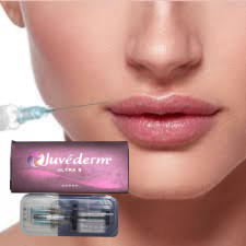 Juvederm Ultra 4 Hyaluronic Acid Lip Fillers Injeksi Lip Enhancement