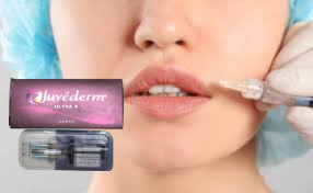 1ml / Kotak Injeksi Lip Fillers Chin Cheeks Cross Linked HA Filler