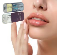 2 X 1 ml Juvederm Ultra 4 Injeksi Filler Kulit Injeksi Lip Filler