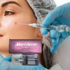 Ultra3 Injectable Hyaluronic Acid Gel Juvederm Dermal Filler Untuk Lip Filler