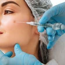 Goresan halus Filler Kulit Injeksi Asam Hialuronik Juvederm Ultra 3 2*1ml